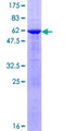 SULT1E1 / Sulfotransferase 1E1 Protein - 12.5% SDS-PAGE of human SULT1E1 stained with Coomassie Blue