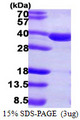 SULT2A1 / Sulfotransferase 2A1 Protein