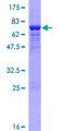 SULT2B1 / Sulfotransferase 2B1 Protein - 12.5% SDS-PAGE of human SULT2B1 stained with Coomassie Blue