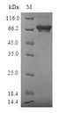 SULT2B1 / Sulfotransferase 2B1 Protein - (Tris-Glycine gel) Discontinuous SDS-PAGE (reduced) with 5% enrichment gel and 15% separation gel.