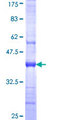 SULT2B1 / Sulfotransferase 2B1 Protein - 12.5% SDS-PAGE Stained with Coomassie Blue.