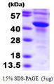 SULT2B1 / Sulfotransferase 2B1 Protein