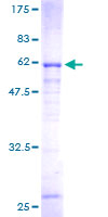SULT4A1 / Sulfotransferase 4A1 Protein - 12.5% SDS-PAGE of human SULT4A1 stained with Coomassie Blue