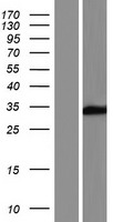 SULT6B1 / Sulfotransferase 6B1 Protein - Western validation with an anti-DDK antibody * L: Control HEK293 lysate R: Over-expression lysate