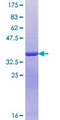 SUMF1 Protein - 12.5% SDS-PAGE Stained with Coomassie Blue.