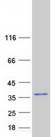 SUMF2 Protein - Purified recombinant protein SUMF2 was analyzed by SDS-PAGE gel and Coomassie Blue Staining
