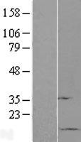 SUMO1 / SMT3 Protein - Western validation with an anti-DDK antibody * L: Control HEK293 lysate R: Over-expression lysate