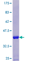SUMO1 / SMT3 Protein - 12.5% SDS-PAGE of human SUMO1 stained with Coomassie Blue
