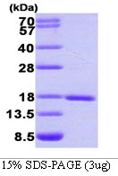 SUMO1 / SMT3 Protein