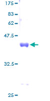 SUMO2 Protein - 12.5% SDS-PAGE of human SUMO2 stained with Coomassie Blue
