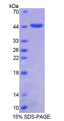 SUMO2 Protein - Recombinant  Small Ubiquitin Related Modifier Protein 2 By SDS-PAGE