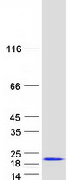 SUMO3 Protein - Purified recombinant protein SUMO3 was analyzed by SDS-PAGE gel and Coomassie Blue Staining