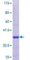 SUMO4 Protein - 12.5% SDS-PAGE of human SUMO4 stained with Coomassie Blue