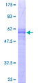 SUN1 Protein - 12.5% SDS-PAGE of human UNC84A stained with Coomassie Blue