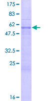 SUN1 Protein - 12.5% SDS-PAGE of human UNC84A stained with Coomassie Blue