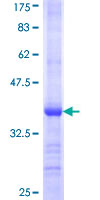 SUOX / Sulfite Oxidase Protein - 12.5% SDS-PAGE Stained with Coomassie Blue.