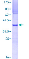 SUPT16H / FACTP140 Protein - 12.5% SDS-PAGE Stained with Coomassie Blue.