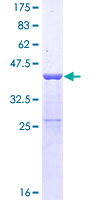 SUPT4H1 / SPT4 Protein - 12.5% SDS-PAGE of human SUPT4H1 stained with Coomassie Blue