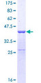 SUPT4H1 / SPT4 Protein - 12.5% SDS-PAGE of human SUPT4H1 stained with Coomassie Blue