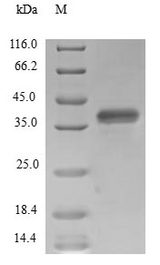 SUPT4H1 / SPT4 Protein - (Tris-Glycine gel) Discontinuous SDS-PAGE (reduced) with 5% enrichment gel and 15% separation gel.