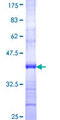 SUPT4H1 / SPT4 Protein - 12.5% SDS-PAGE Stained with Coomassie Blue.