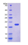 SUPT6H / SPT6 Protein - Recombinant Suppressor Of Ty 6 Homolog By SDS-PAGE