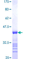 SUPV3L1 Protein - 12.5% SDS-PAGE Stained with Coomassie Blue.