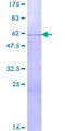 SURF1 Protein - 12.5% SDS-PAGE of human SURF1 stained with Coomassie Blue