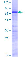 SURF2 / SURF-2 Protein - 12.5% SDS-PAGE of human SURF2 stained with Coomassie Blue