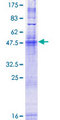 SURF4 Protein - 12.5% SDS-PAGE of human SURF4 stained with Coomassie Blue
