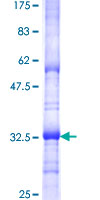 SURF4 Protein - 12.5% SDS-PAGE Stained with Coomassie Blue.
