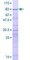 SURF6 Protein - 12.5% SDS-PAGE of human SURF6 stained with Coomassie Blue