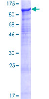 SUSD2 Protein - 12.5% SDS-PAGE of human SUSD2 stained with Coomassie Blue