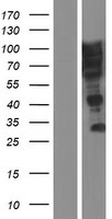 SUSD5 Protein - Western validation with an anti-DDK antibody * L: Control HEK293 lysate R: Over-expression lysate