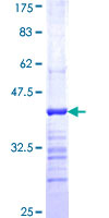 SUSD5 Protein - 12.5% SDS-PAGE Stained with Coomassie Blue.