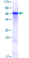 SUSD6 / KIAA0247 Protein - 12.5% SDS-PAGE of human KIAA0247 stained with Coomassie Blue