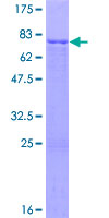 SUV39H1 Protein - 12.5% SDS-PAGE of human SUV39H1 stained with Coomassie Blue