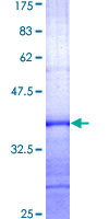 SUV39H1 Protein - 12.5% SDS-PAGE Stained with Coomassie Blue.