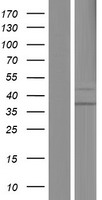 SUV420H1 Protein - Western validation with an anti-DDK antibody * L: Control HEK293 lysate R: Over-expression lysate