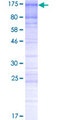 SUV420H1 Protein - 12.5% SDS-PAGE of human SUV420H1 stained with Coomassie Blue