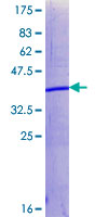 SUZ12 Protein - 12.5% SDS-PAGE Stained with Coomassie Blue.