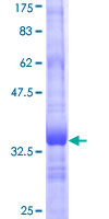 SV2B Protein - 12.5% SDS-PAGE Stained with Coomassie Blue.