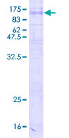 SV2C Protein - 12.5% SDS-PAGE of human SV2C stained with Coomassie Blue