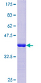 SV2C Protein - 12.5% SDS-PAGE Stained with Coomassie Blue.