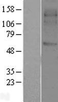 SVOP Protein - Western validation with an anti-DDK antibody * L: Control HEK293 lysate R: Over-expression lysate