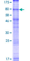 SVOP Protein - 12.5% SDS-PAGE of human SVOP stained with Coomassie Blue