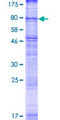 SVOP Protein - 12.5% SDS-PAGE of human SVOP stained with Coomassie Blue