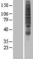 SVOPL Protein - Western validation with an anti-DDK antibody * L: Control HEK293 lysate R: Over-expression lysate