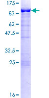 SWAP70 Protein - 12.5% SDS-PAGE of human SWAP70 stained with Coomassie Blue