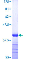 SWAP70 Protein - 12.5% SDS-PAGE Stained with Coomassie Blue.